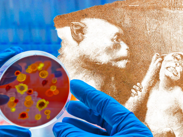 Vaiolo scimmie: due nuovi casi in Lombardia